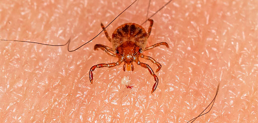 Mitos e Verdades sobre a febre maculosa