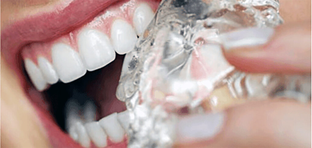 Roer gelo para fugir do calor pode danificar os dentes/ Foto: Internet