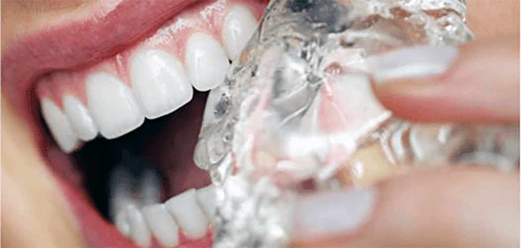 Roer gelo para fugir do calor pode danificar os dentes/ Foto: Internet