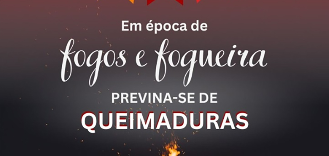 Queimaduras nas festas juninas: Mitos e verdades que você precisa saber
