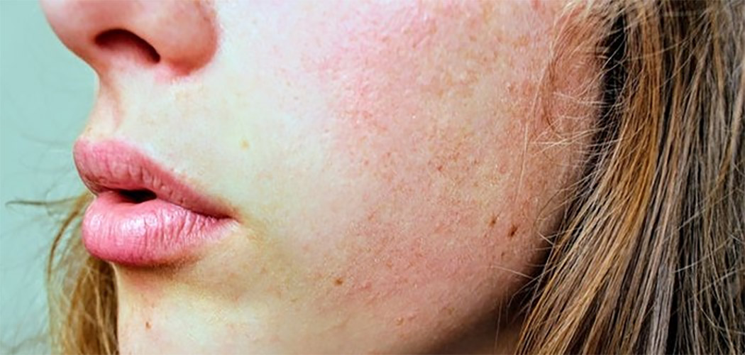 8 cuidados para quem tem alergia à maquiagem