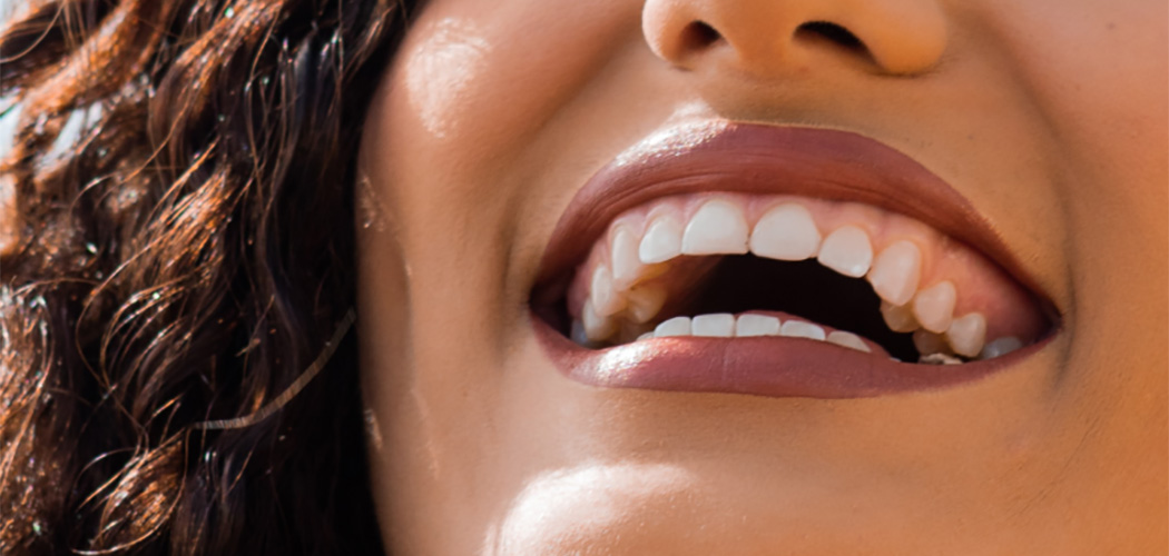 O sorriso espontâneo proporciona diversos benefícios físicos, emocionais e sociais