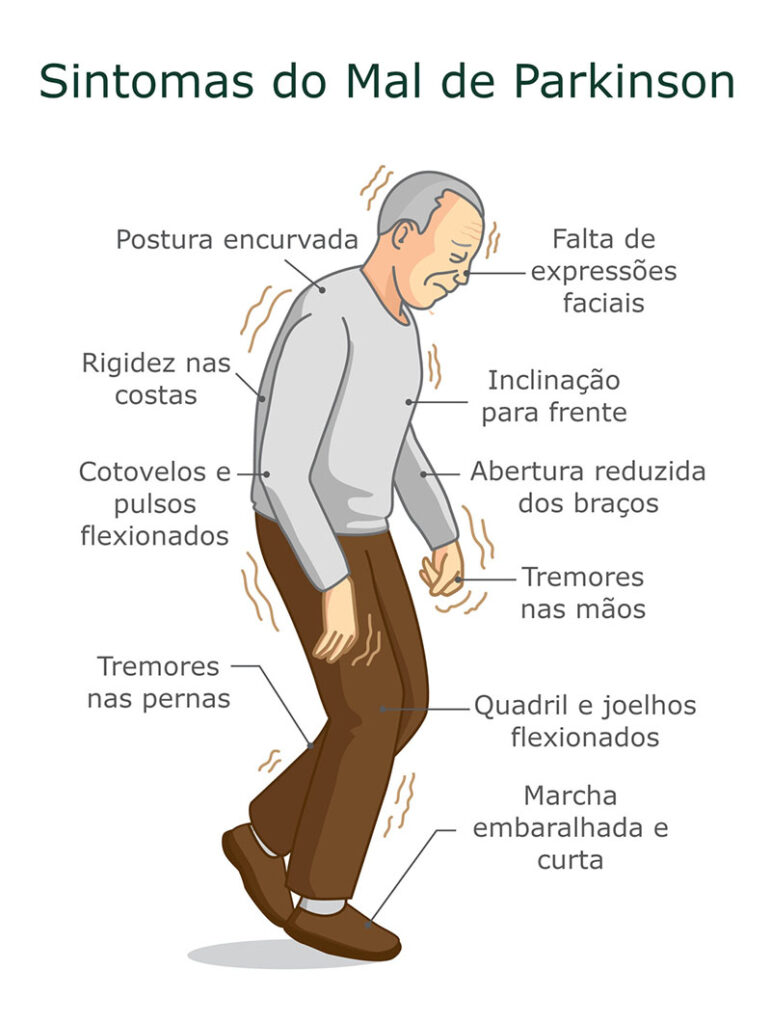Dia Nacional do Parkinsoniano (04/04): conscientização, respeito e qualidade de vida
