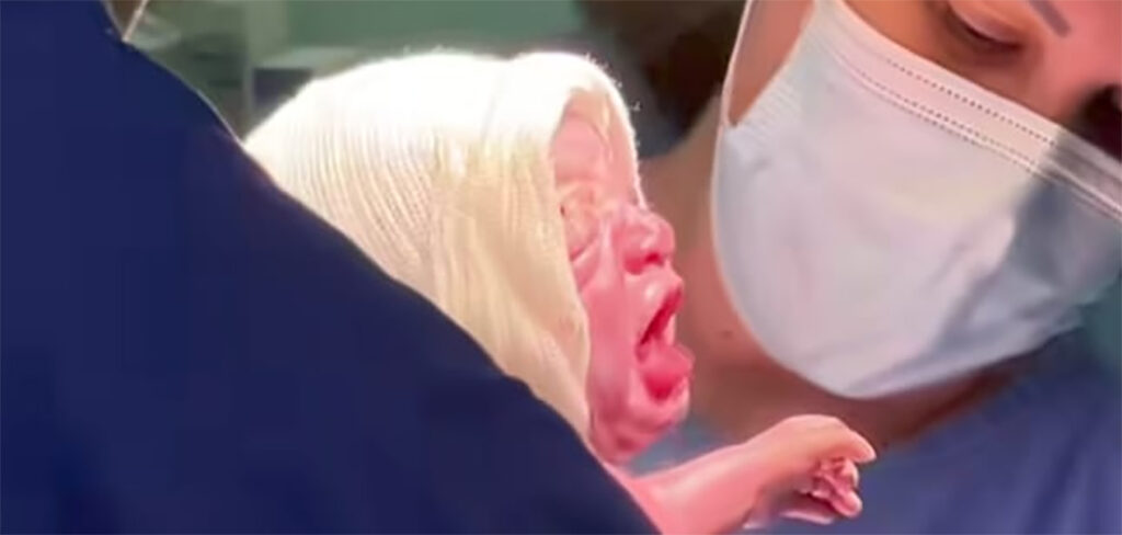 Trigêmeos nascem no HUST e reforçam a importância da UTI Neonatal e Pediátrica para Joaçaba e região