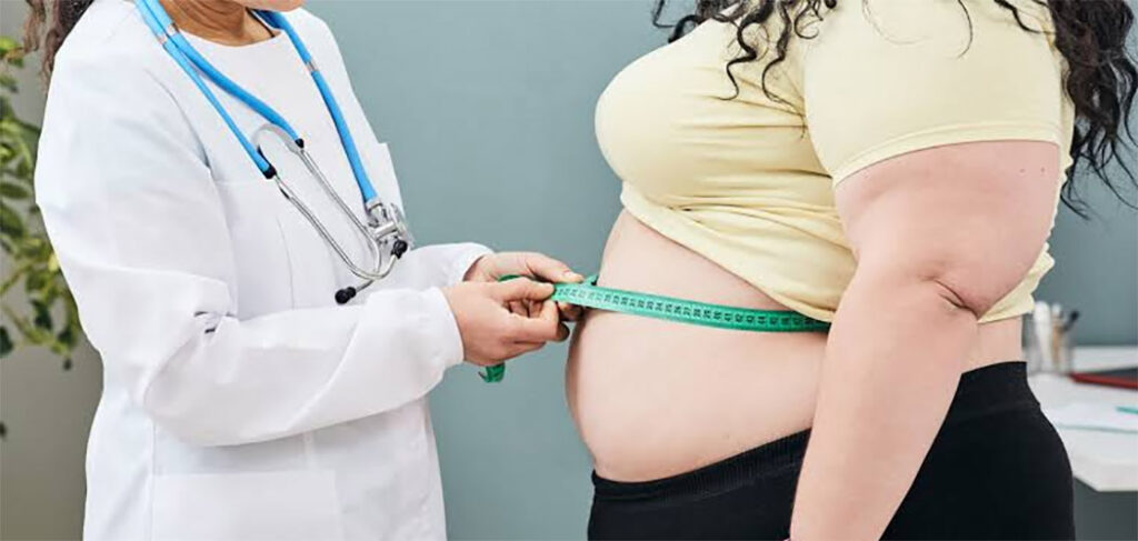 Obesidade afeta um a cada quatro brasileiros adultos e pode atingir a maior parte da população até 2030, dizem estudos