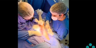 Cirurgias para o tratamento de lesões em nervos periféricos são realizadas no HUST Joaçaba