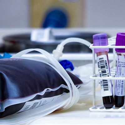 Hemosc tem crescimento de 3,4% no volume de doações de sangue em 2022/Foto: Mauricio Vieira-Secom Governo de SC