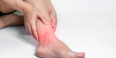 Porque seu tornozelo está inchado? Confira as causas e soluções