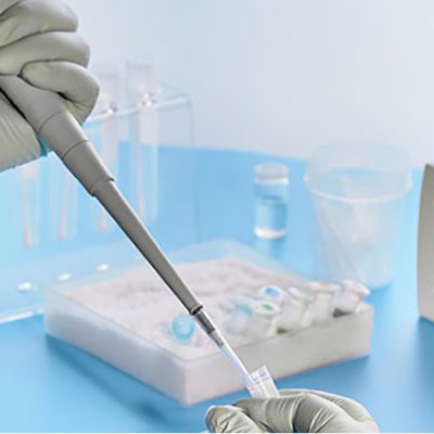 Diagnóstico laboratorial para detecção do SARS CoV 2 é feito pela metodologia RT-PCR em tempo real, pelo protocolo CDC/EUA